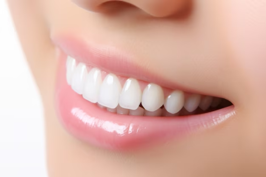 Bright smile after professional teeth whitening treatment
