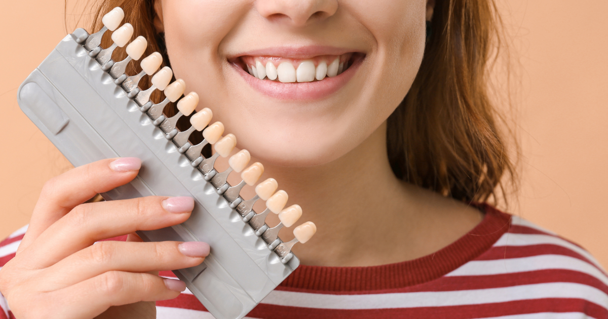 Patient smiling after porcelain veneer treatment