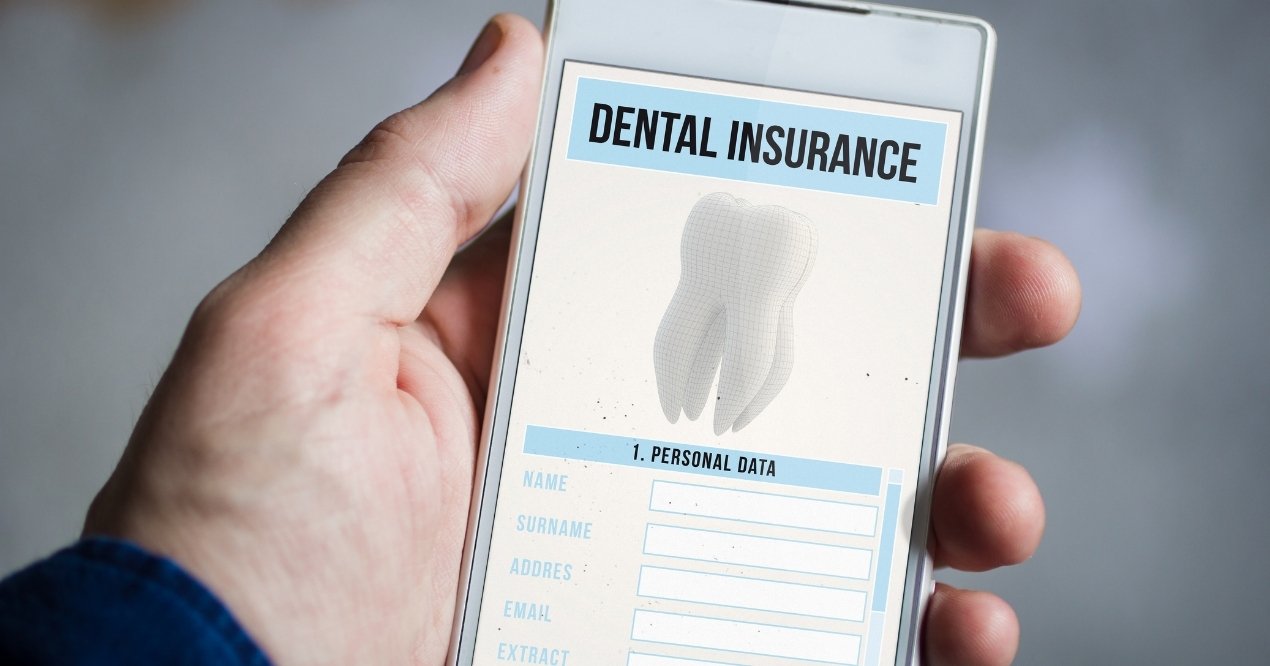 Dental insurance card highlighting coverage benefits