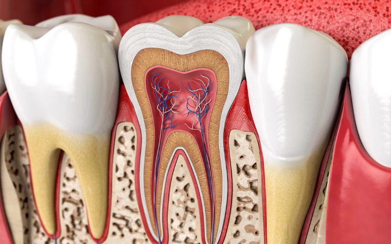 Illustration showing root canal solutions
