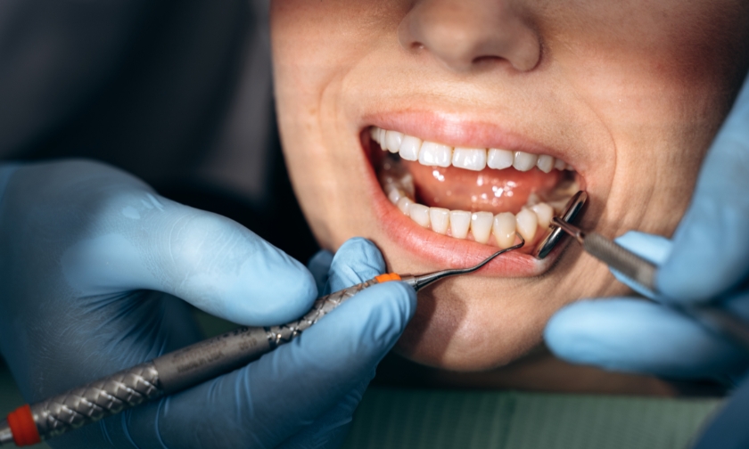 Patient receiving a professional dental examination