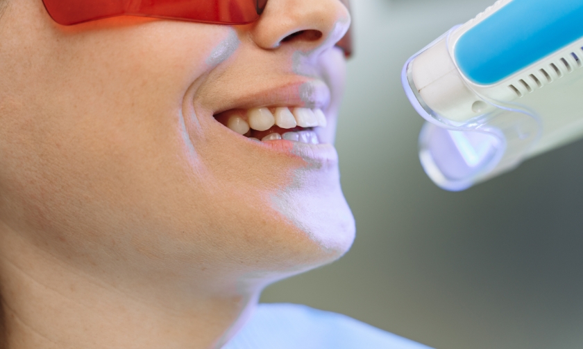 Patient smiling during teeth whitening treatment