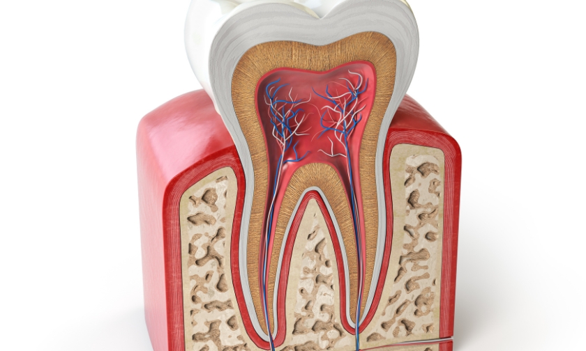 Cross section illustration showing tooth infection