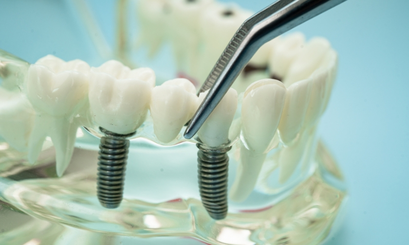 Dental implant being cleaned with a dental instrument