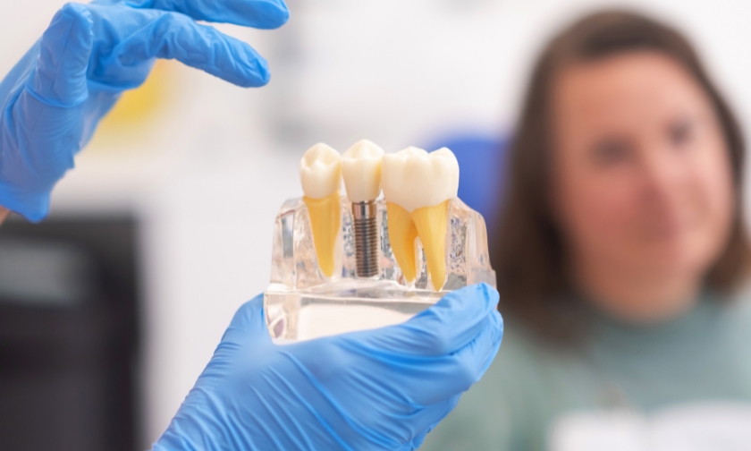Dental implant model displayed during consultation