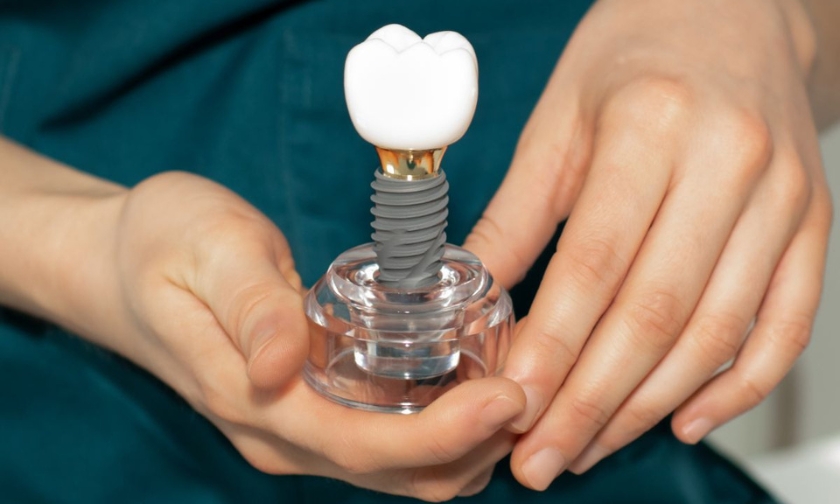 Dental implant model held by a patient