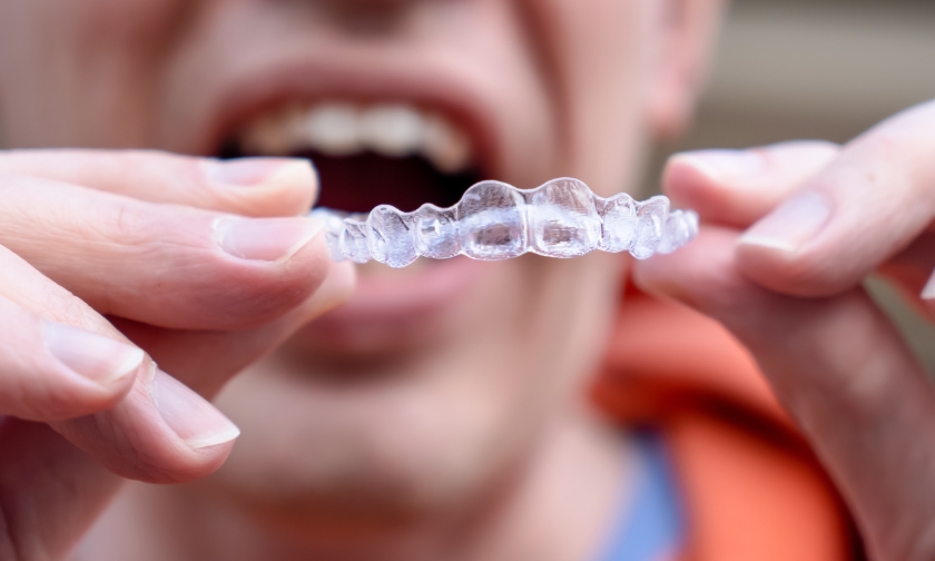 Patient holding a clear Invisalign aligner