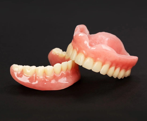 Full denture restoration model