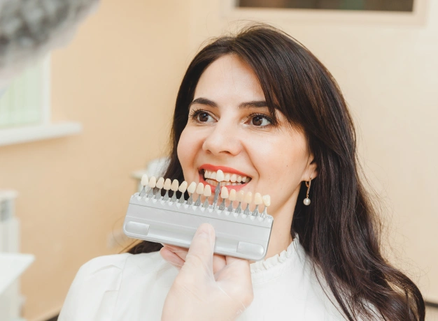Dentist holding veneers near the mouth of a patient