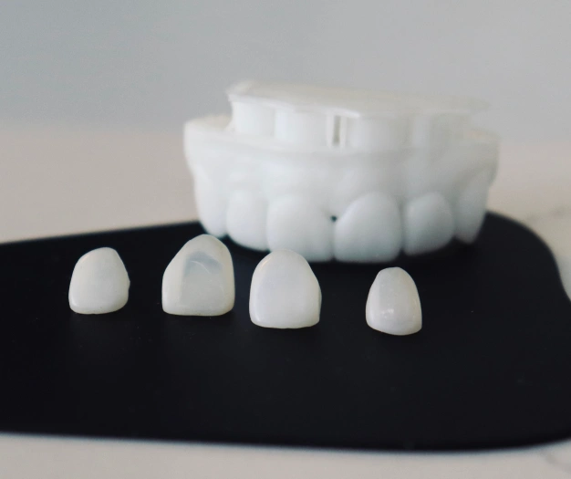 Porcelain veneers placed on a dark background