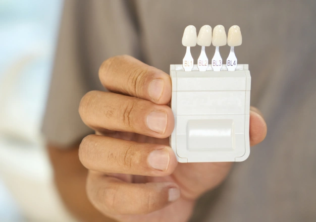 Hand holding porcelain veneers
